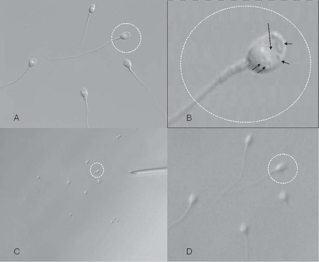Figure 3. Spermatozoa with Nomarski and Hoffman optic systems at different magnifications. (A) Nomarski differential interference contrast at 1000 magnification ( 100 DIC objective).