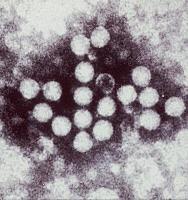Characteristics of hepatitis A virus Picornaviridae VIRON= naked, small