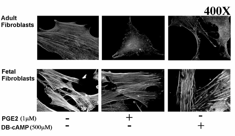 Figure 21. PGE2 and camp destabilize the actin cytoskeleton of adult but not fetal fibroblasts.