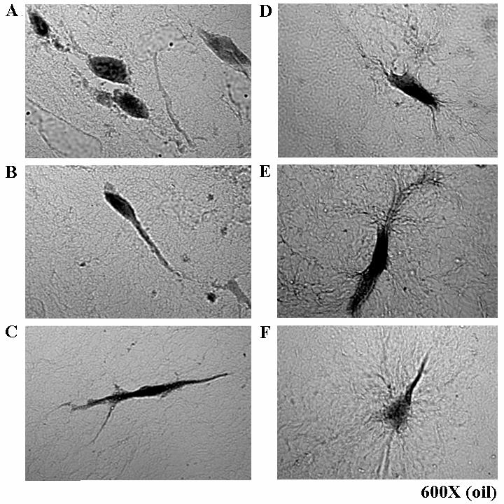 Individual fibroblast activity within collagen construct. The analysis detailed above focused primarily on population wide dynamics within the 3D collagen gel constructs.