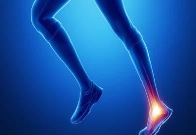 ACHILLES TENDINOPATHY Palpation tenderness of Achilles is not diagnostic Think