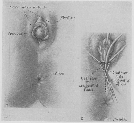 2. A, external genitalia.