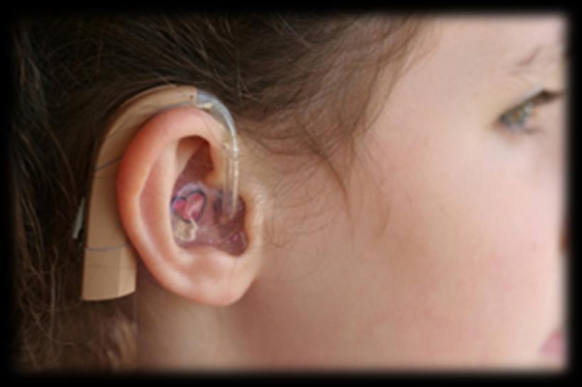 Who is involved with Deaf or hearing impaired children?