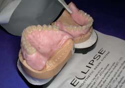 Make sure to return the denture for tryin using only completely opaque bags or boxes.