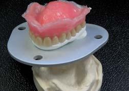 Lift the rebased denture from the cast and clamp it in place in the top part of the