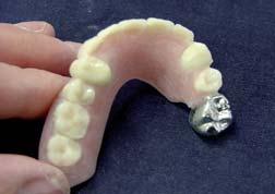 Paint the denture with ABC varnish and place in the pre-heating oven for one hour.