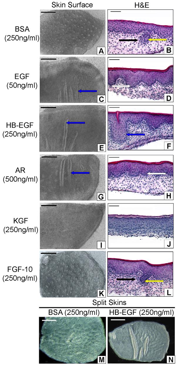 2156 RESEARCH ARTICLE Development 136 (13) Inhibition of follicle morphogenesis by EGFR and FGFR2(IIIb) activation is dose dependent, morphology and patterning of residual hair follicles is normal To