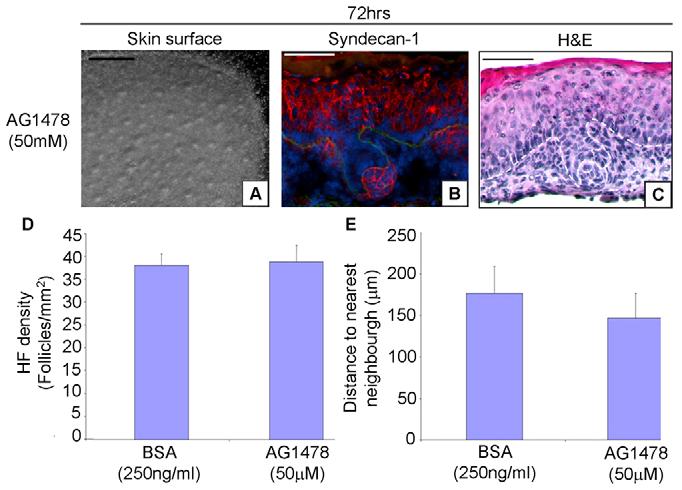 Control of hair follicle morphogenesis by KGF and EGF RESEARCH ARTICLE 2161 Fig. 7. Inhibition of EGFR signalling has no effect on hair follicle development or density. (A-E) Skins from E13.