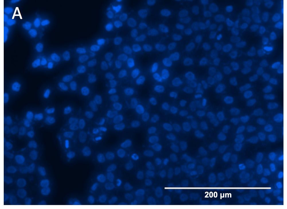 628 Antiproliferative activity of Withania somnifera Figure 3. Fluorescent photomicrographs (x20) of cells stained with Hoechst 33342 and treated with active dichloromethane fraction of W.