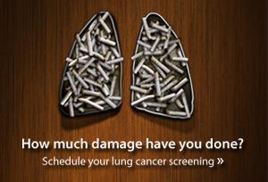 Incorporating Radiology into Your Corporate Health Program CT Lung Cancer Screening: Lung cancer accounts for 1 out of 3