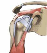 YOU HAVE A DAMAGED BICEPS AT THE SHOULDER YOU ARE GOING TO UNDERGO BICEPS SURGERY What is a damaged biceps at the shoulder? The shoulder is the joint between the scapula and the humerus.