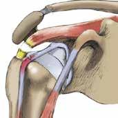 The rotator cuff tendons connect the muscles to the bone.