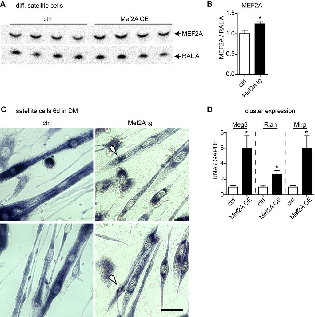 Figure S7: Forced expression of Mef2A increases expression of Dlk1-Dio3 cluster components and disturbs the mitochondrial network in differentiating MuSC -Related to Figure 7.