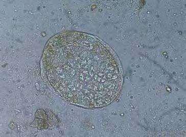 Image illustrating Yeast Cells
