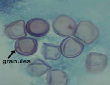 similarity to parasitic oocysts.