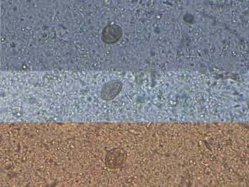 Image illustrating pollen in slide preparation