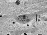 Negri bodies Primary human fibroblasts HSV Adenovirus: ells, inclusions TEM NIH3T3