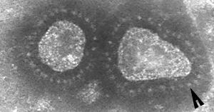 ells, inclusions Rota Syncytia CMV: owl eyed nucleus Corona Principles of Virology:
