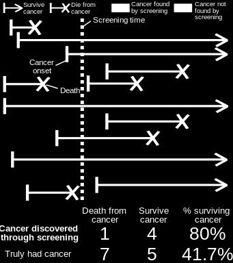 LENGTH TIME BIAS Screening detects clinically insignificant cancers Slow-growing