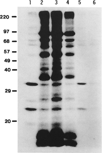 1 -~ ADP; lane 5, [y-32p]gtp+10 gml.1-1 GDP; lane 6, [y- 32P]GTP+100 laml.l -~ GDP. Samples were analyzed n a 121/2% running gel; all ther cnditins were as described in Material and methds Fig. 6. Detectin f a nucletide triphsphate-nucletide diphsphate phsphtransferase in the uter-envelpe membrane fractin f pea chlrplasts.