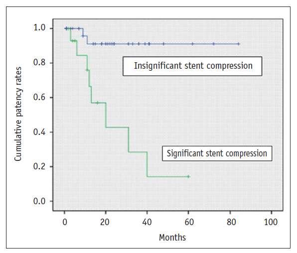 48 patients with iliac compression and acute DVT followed for average of 20 months Follow-up was performed