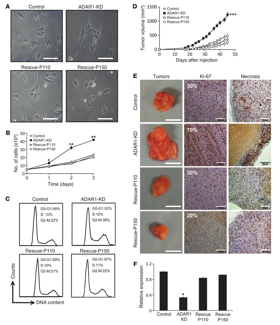 research article Figure 2 Reduced expression of ADAR1 enhances cancerous features both in vivo and in vitro. (A) Morphology of the cells was assessed using a phasecontrast microscope.