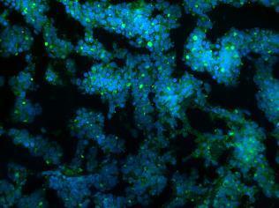cells in mouse neuroblastoma model Source: Heczey et al.