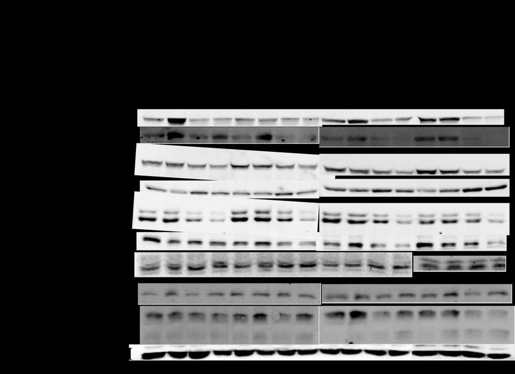 Figure 13. Western blot analysis of GBM12 cells at 3, 6, 12 and 24 hours after exposure to sorafenib and lapatinib.