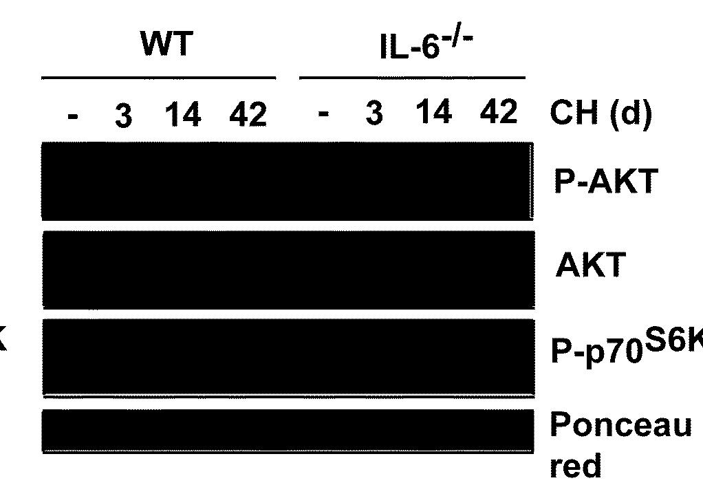 AKT-mTOR Protein synthesis IL-6