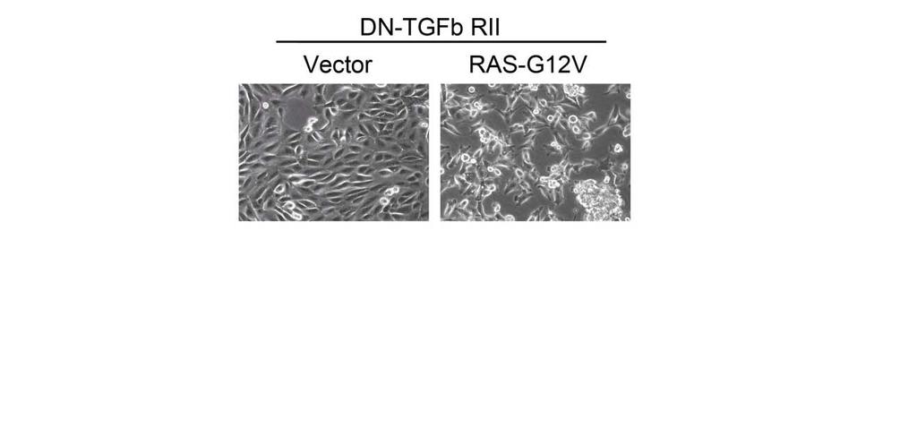 Figure III-5: Inhibition of TGF-β signaling in shp53/ras-g12v-hmecs. Representative images of shp53/ras-g12v-hmecs expressing either an empty vector or DN-TGFβRII.