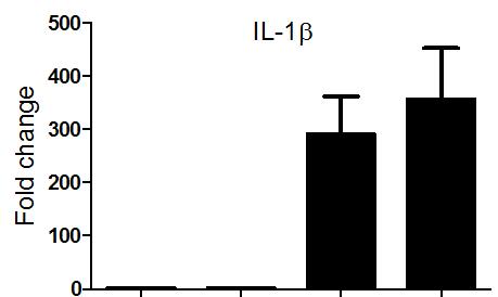 Supplementary figure vi Polarization of one marrow derived macrophages Macrophage M1 Polarization A B C a a Control Rosuvastatin Control Rosuvastatin No LPS LPS a a Control Rosuvastatin Control