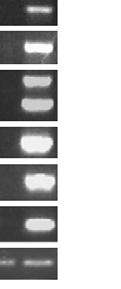 In some instances, non-specific PCR bands weree also detected