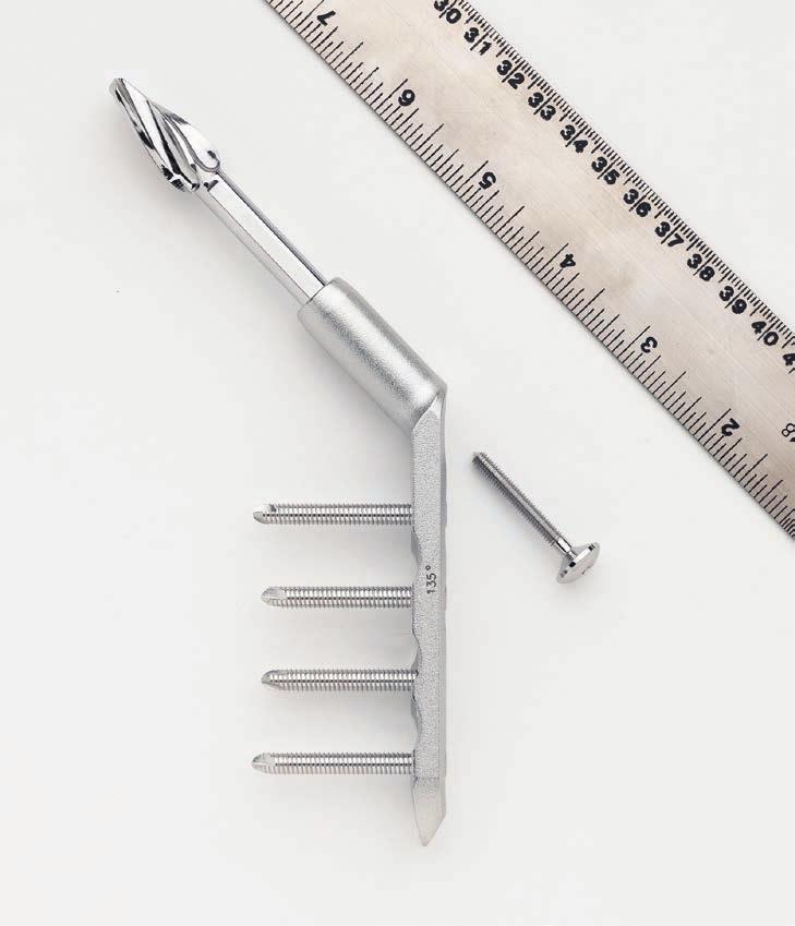 which a stable medial buttress can be reconstructed. Additionally, implantation methods are simplified by minimized instrumentation.
