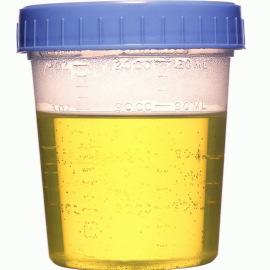 Urine Formation Urinary Physiology Urinary Section pages 9-17 Filtrate Blood plasma minus most proteins Urine <1% of total filtrate Contains metabolic wastes and unneeded