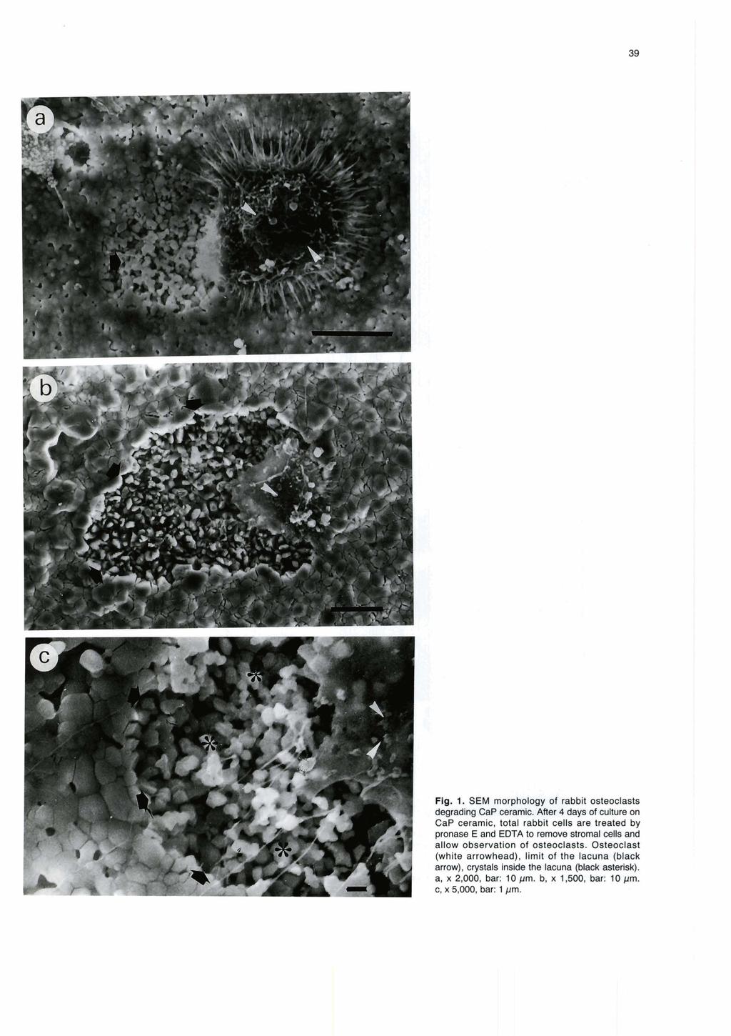 Fig. 1. SEM rnorphology of rabbit osteoclasts degrading Cap ceramic.