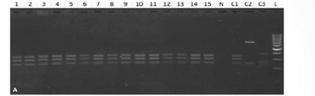 , 1998 Nadler SA, 2000 Mattiucci S, 2011 391/390 Nadler SA, 2005 Iniguez AM, 2009 RFLP PCR RFLP analysis using HInfI Using NC5/NC2 primers (Zhu X.