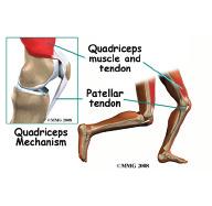 below the patella. The tendon together with the patella is called the quadriceps mechanism.