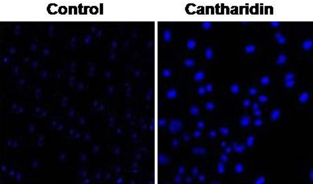 Figure 2. Cantharidin treatment for 48 h altered the morphological features of KOSC-2 cells.