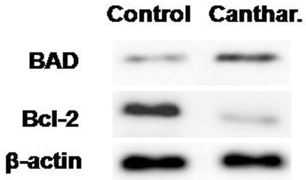Figure 4. Effect of cantharidin on expression of BAD and Bcl-2 using western blot analysis. β-actin was used as the loading control and the bands were quantified by ImageJ software.