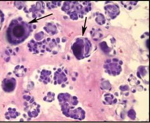 features suggesting papillary formation,