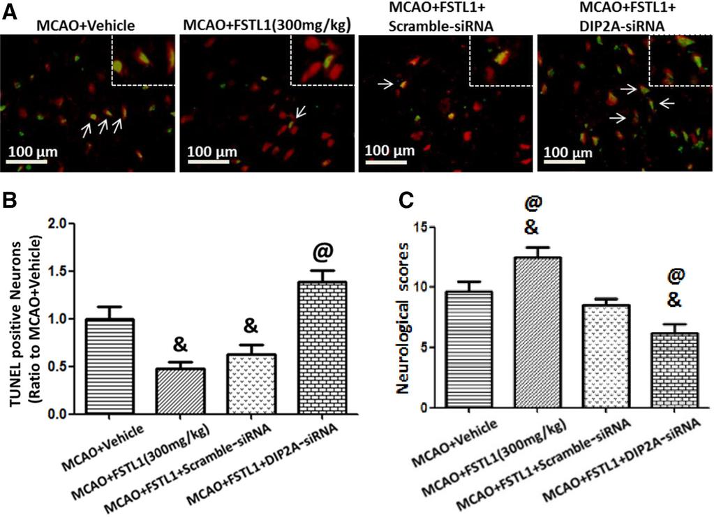DIP2A-siRNA increased neuron apoptosis (A and B) and increased neurological deficits (C) in FSTL1-treated rats after MCAO. n=6 for each group. &P<0.05 vs MCAO+vehicle; @P<0.