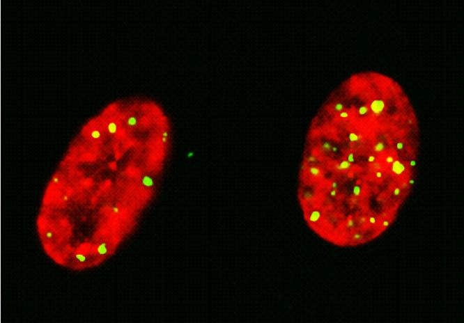 RESULTS AND DISCUSSION Figure 6. Photographs of Chk2-foci (green) in cell nuclei stained with propidium iodide receiving 1 Gy 211 At (left) or in unirradiated cells (right), 48 h post-irradiation.