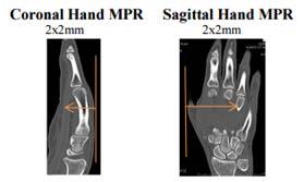 Images should be displayed with fingers at top on sagittal and coronals. Dorsum of the hand on top for axial images.