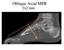 Include oblique axial reformations if needed.