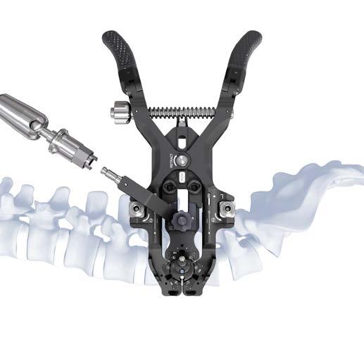Attach Retractor to Strong Arm or Universal Arm Attach connector to strong arm or universal arm (,,3) and tighten the stabilizing system by turning the knob on the arm (4).