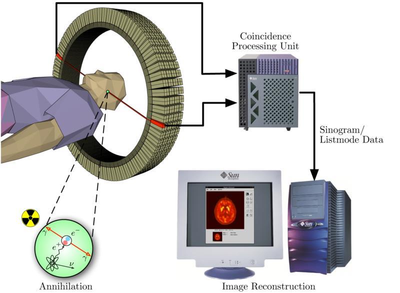 Positron Emission Tomography: Basic Principle Image