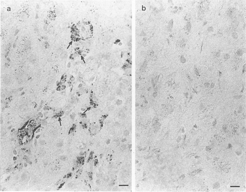 VOL. 36, 1982 Immunoperoxidase staining. We performed the direct conjugate staining method as follows.