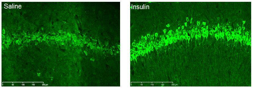 Figure 2. Neun staining was increased with intranasal insulin treatment TBI results in neuronal cell death. Neuronal cell death in the hippocampus impairs memory function.