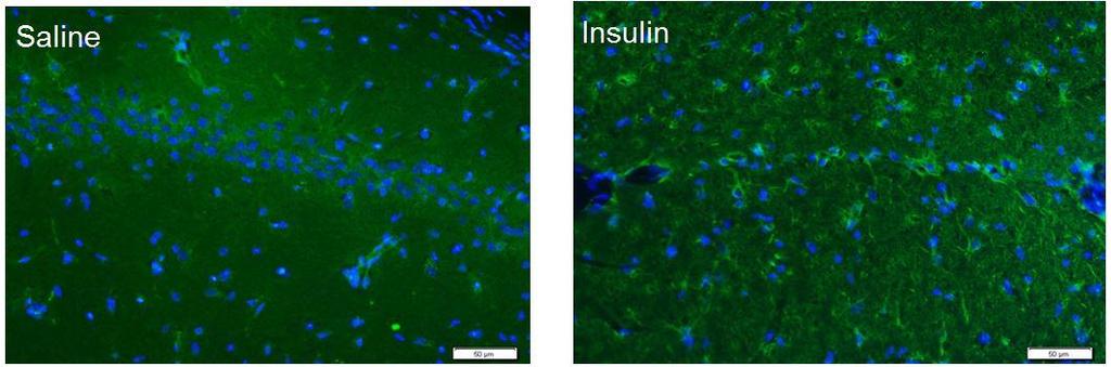 Qualitative assessment of histology showed improved neuronal viability in the hippocampus of the insulin treated rats. Figure 3.