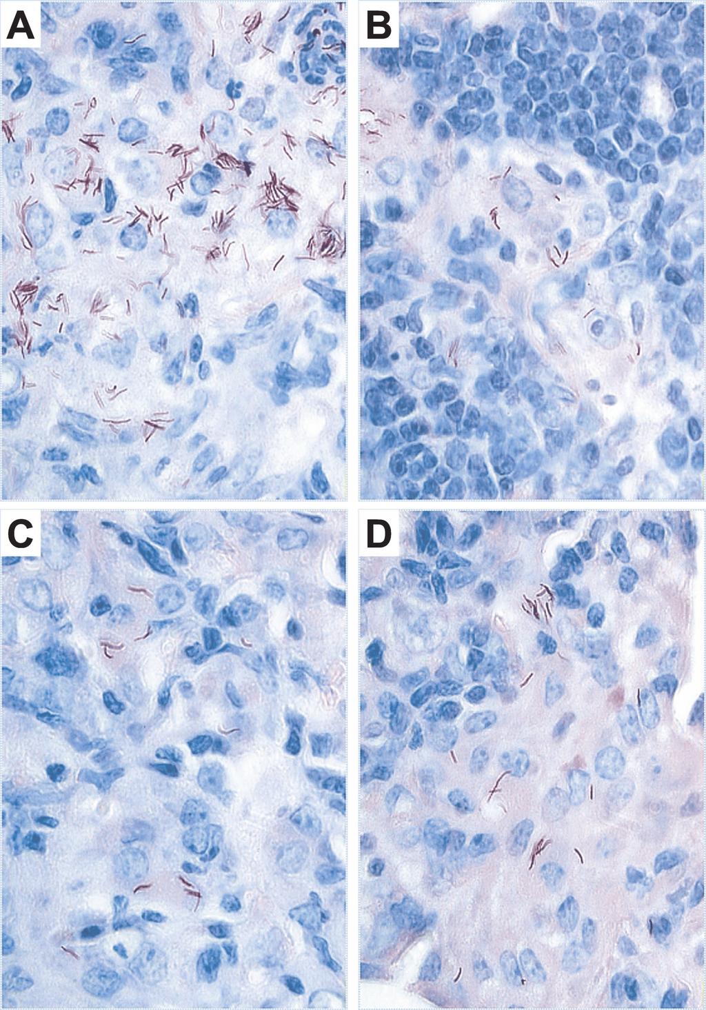 VOL. 70, 2002 DNA VACCINATION AGAINST TUBERCULOSIS 297 FIG. 3. Acid-fast bacillus staining of lung tissues from vaccinated mice infected with M. tuberculosis.